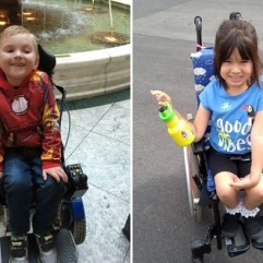 Spinal muscular atrophy